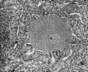 Rabies Virus